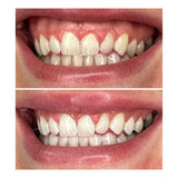 SBS Whitening
