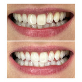 SBS Whitening