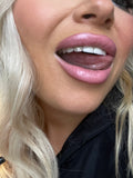 SBS Whitening